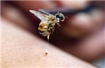Chuyên gia hướng dẫn cách xử trí khi bị ong đốt