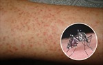 Đà Nẵng: Xuất hiện nhiều ổ bệnh sốt xuất huyết
