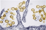 Ba người chết trên tàu biển: Virus Hanta nguy hiểm ra sao?