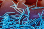 Mỹ: Cơ quan tiêm chủng ủng hộ loại thuốc mới phòng bệnh do virus RSV cho trẻ em