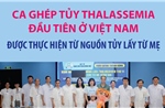 Ca ghép tủy Thalassemia đầu tiên ở Việt Nam được thực hiện từ nguồn tủy lấy từ mẹ