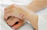 Nga chế xuất vật liệu tự chữa lành vết thương