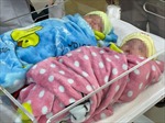 Kỳ diệu cặp trẻ song sinh chỉ nặng 500gram đã được nuôi dưỡng thành công