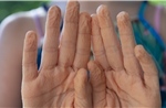Phát hiện bất ngờ về hiện tượng ngón tay nhăn nheo khi ngâm nước