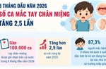 Số ca mắc tay chân miệng tăng 2,5 lần