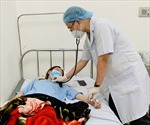 Bệnh đậu mùa khỉ xuất hiện tại Việt Nam: Không nên quá lo lắng