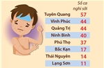 Số ca nghi sởi tại một số tỉnh, thành phố