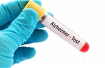 Bộ xét nghiệm máu mới giúp phát hiện sớm bệnh Alzheimer