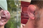 Đàn ông Nga gây sốc với trào lưu làm tai 'súp lơ' để trông đáng sợ hơn