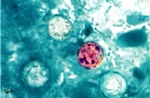 Ký sinh trùng Cyclospora là gì và vì sao đang gây lo ngại tại Mỹ?
