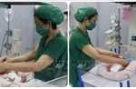Điều trị thành công cho hai thai phụ mang đa thai dọa sinh non