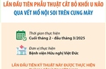 Lần đầu tiên phẫu thuật cắt bỏ khối u não qua vết mổ nội soi trên cung mày