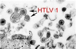 Nghiên cứu dùng virus bạch cầu để điều trị HIV