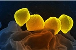 Số ca nhiễm liên cầu khuẩn nguy hiểm tại Nhật Bản tăng mạnh