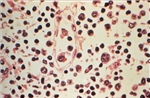 Argentina đặt những chiếc bẫy đầu tiên nhằm tóm vật chủ mang virus Hanta