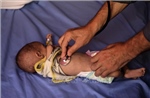 Khởi động việc đưa trẻ ở Gaza đến Anh điều trị y tế
