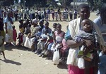 Zimbabwe: Tái bùng phát dịch sởi khiến 80 trẻ em tử vong