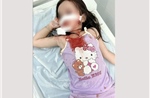 Bé gái 4 tuổi bị chó thả rông tấn công, thương tích nghiêm trọng vùng mặt