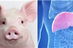Gan lợn biến đổi gene mở ra hướng đi mới trong điều trị suy gan cấp