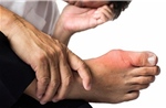 Đối mặt nguy cơ tàn phế sau khi chữa gout bằng phương pháp truyền miệng