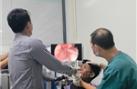 Gắp một con cá rô sống ra khỏi thực quản một bệnh nhân