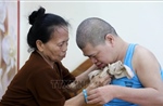65 năm thảm họa da cam: Những vết thương không thể lành
