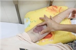 Gia Lai ghi nhận trường hợp tử vong do sốt xuất huyết