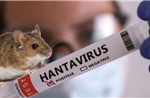 Pháp ghi nhận ca nhiễm mới virus Hanta chủng Andes