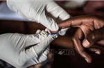 UNAIDS lo ngại việc Mỹ ngừng viện trợ nước ngoài