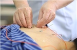 Tạo thuận lợi cho bệnh nhân khám, chữa bệnh bảo hiểm y tế trong lĩnh vực y học cổ truyền 