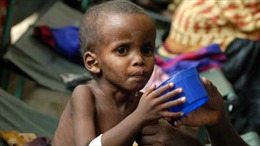 Một triệu trẻ châu Phi có nguy cơ tử vong vì suy dinh dưỡng 