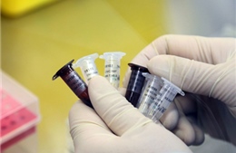 Một người tiếp xúc với bệnh nhân H7N9 có dấu hiệu nhiễm cúm