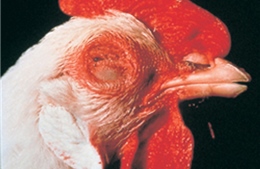 Trị ung thư tiền liệt tuyến bằng virus gây bệnh ở gà
