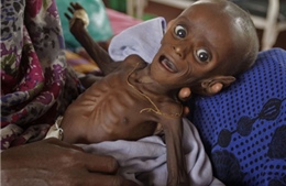 Nạn đói khủng khiếp ở Somalia