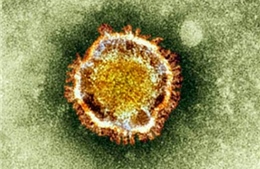 Phát hiện trường hợp nhiễm virus mới tương tự SARS 