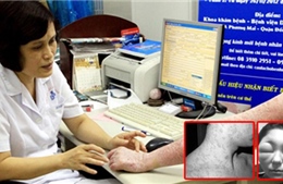 Rước họa vào thân vì tắm trắng