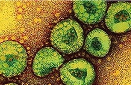 Bộ Y tế khuyến cáo phòng chống lây nhiễm MERS-CoV