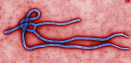 Virus Ebola tấn công cơ thể người thế nào?
