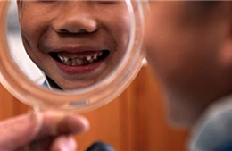 Anh: Giúp trẻ đánh răng ở trường học