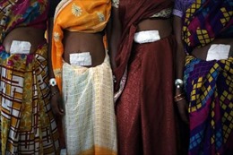 Phụ nữ Ấn Độ - nạn nhân của chính sách ‘triệt sản’