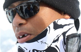 Tiger Woods bị camera &#39;xơi tái&#39; răng cửa