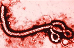 Tìm ra &#39;gót chân Achilles&#39; của virus Ebola 