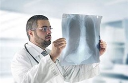 Tia hy vọng mới cho bệnh nhân ung thư phổi 