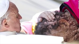 Những khoảnh khắc chạm đến trái tim của Giáo hoàng