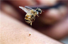 Cấp cứu thành công ca bệnh sốc phản vệ do ong đốt