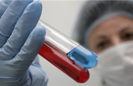 Nga thử nghiệm ba loại vaccine ngừa HIV
