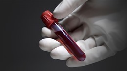 Dụng cụ phát hiện nhanh ung thư bằng mẫu máu