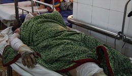 Thêm 2 nạn nhân tử vong trong vụ bỏng xăng tại Đắk Lắk