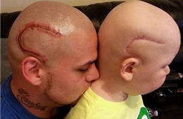 Xăm sẹo đầu để cổ vũ con trai chống ung thư