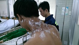 Nổ hoá chất ở chợ "tử thần" Kim Biên, 4 người bị bỏng